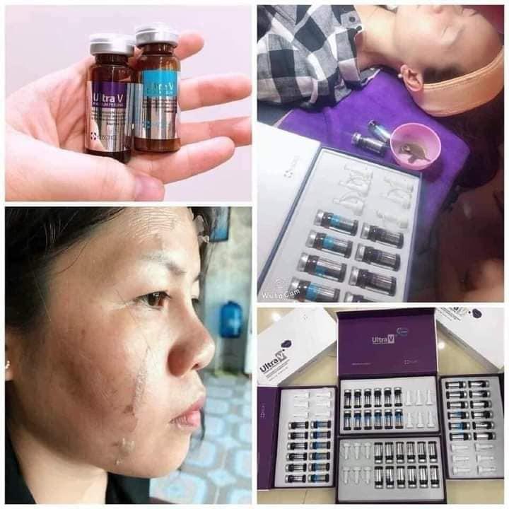 Vi Kim Tảo Biển UltraV Mẫu Mới 2021