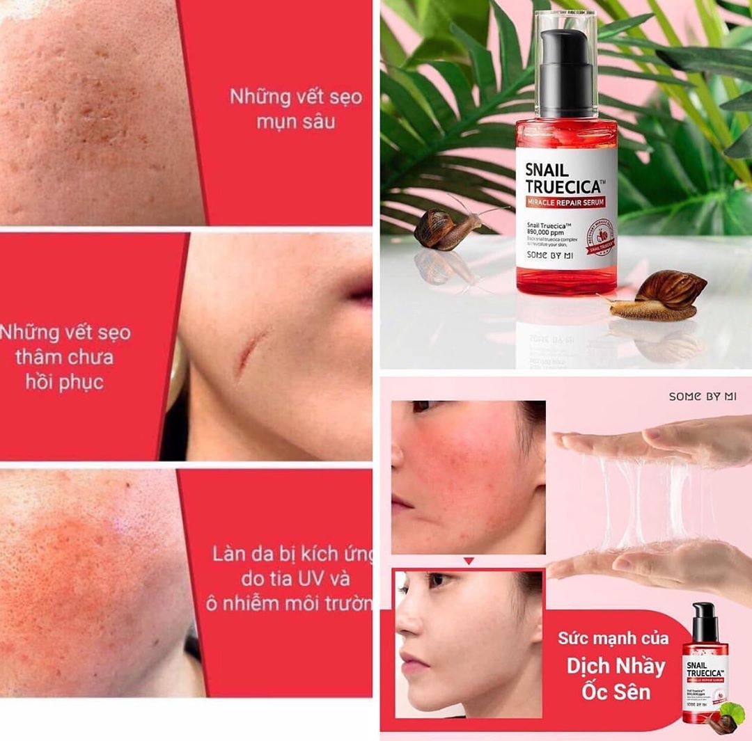 Combo Nước Hoa Hồng + Serum Dưỡng Phục Hồi, Cải Thiện Vết Thâm, Sẹo Some By Mi Snail Truecica Miracle Repair