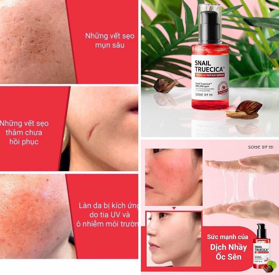 Combo Nước Hoa Hồng + Serum Dưỡng Phục Hồi, Cải Thiện Vết Thâm, Sẹo Some By Mi Snail Truecica Miracle Repair (Toner + Serum)