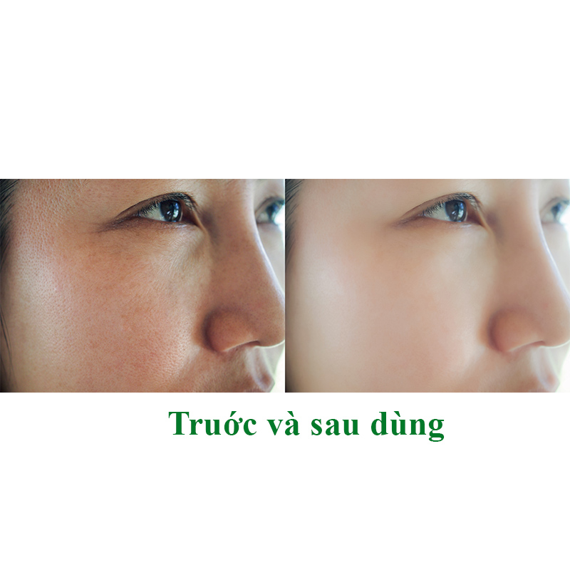 Naruko – Ý dĩ nhân đỏ sáng da mới – Mặt nạ se trắng sáng da hộp 10 miếng – Raw Job’s Tears Brightening Mask