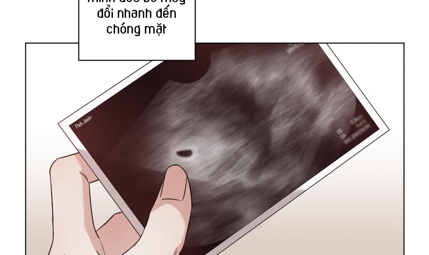 hội chứng minmotion chapter 55 9