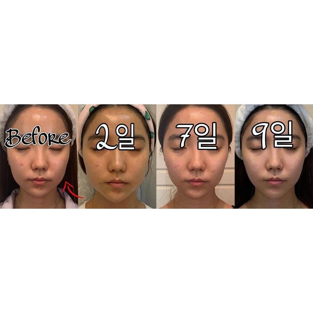 Bộ mặt nạ ampoule nâng cơ, làm sáng và chống lão hoá Dr.NDS Vlifting & Brightening mask