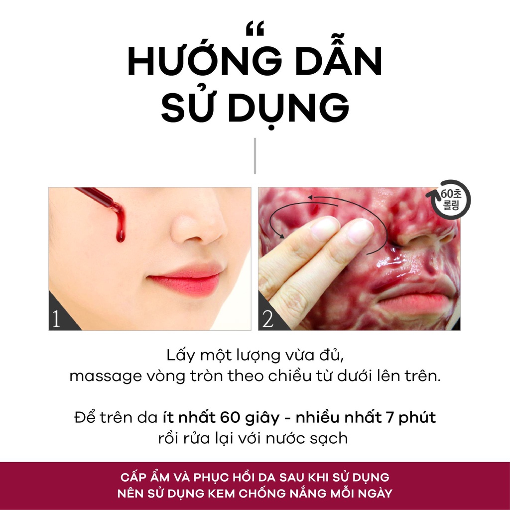 Red Peel Tingle Serum tinh chất tái tạo da sinh học mờ thâm trắng da So Natural 35ml