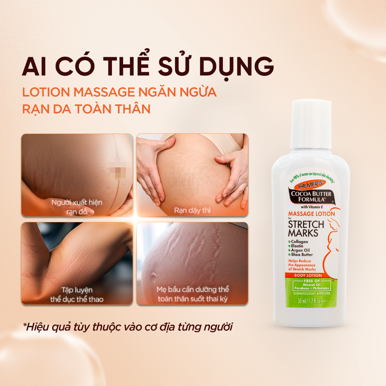 (Mini Size) Dưỡng thể ngừa rạn đầu thai kì 50ml