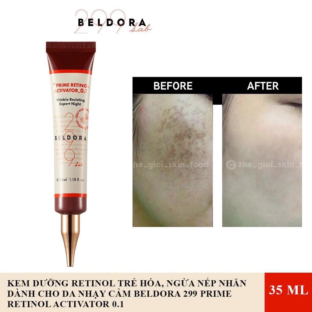 Kem Dưỡng Retinol Trẻ Hóa, Ngăn Ngừa Nếp, Căng Bóng Da Beldora 299 Prime Retinol Activator 35ml