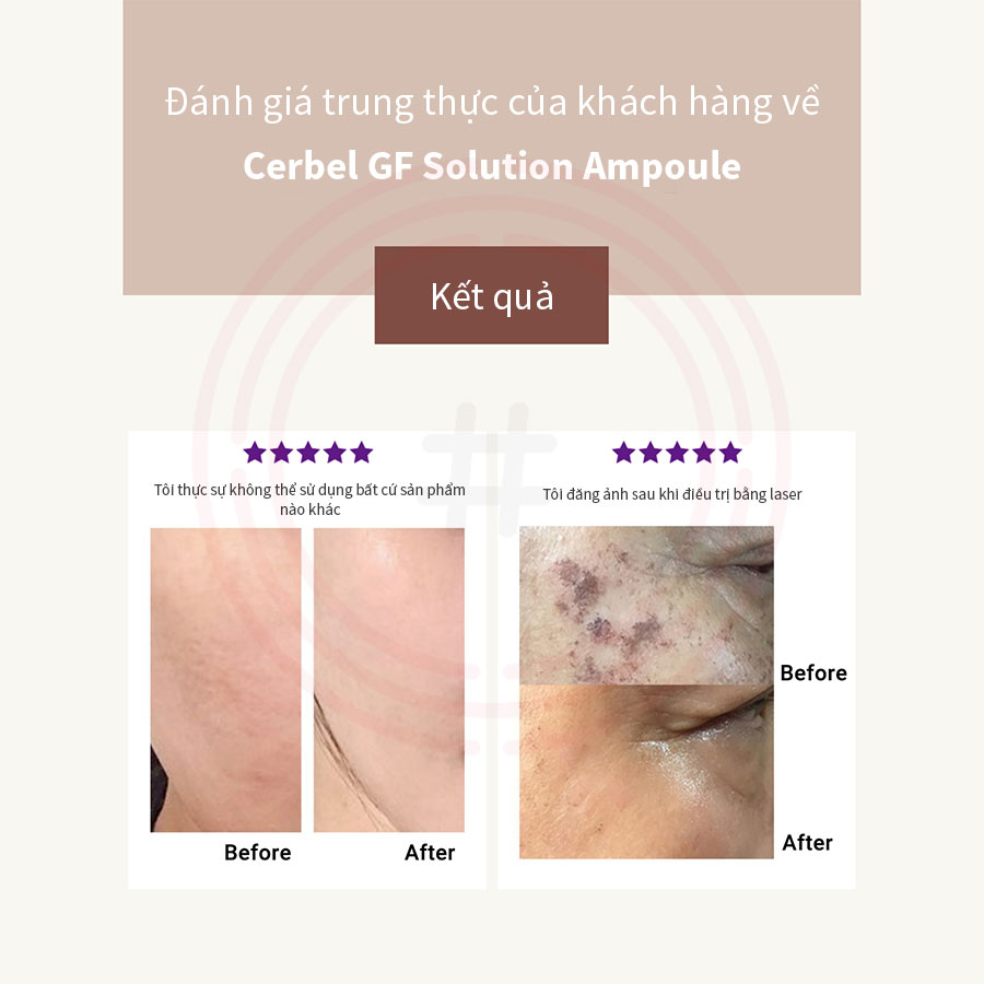 Tinh chất dưỡng da chống lão hóa Cierbel CF Solution Ampoule