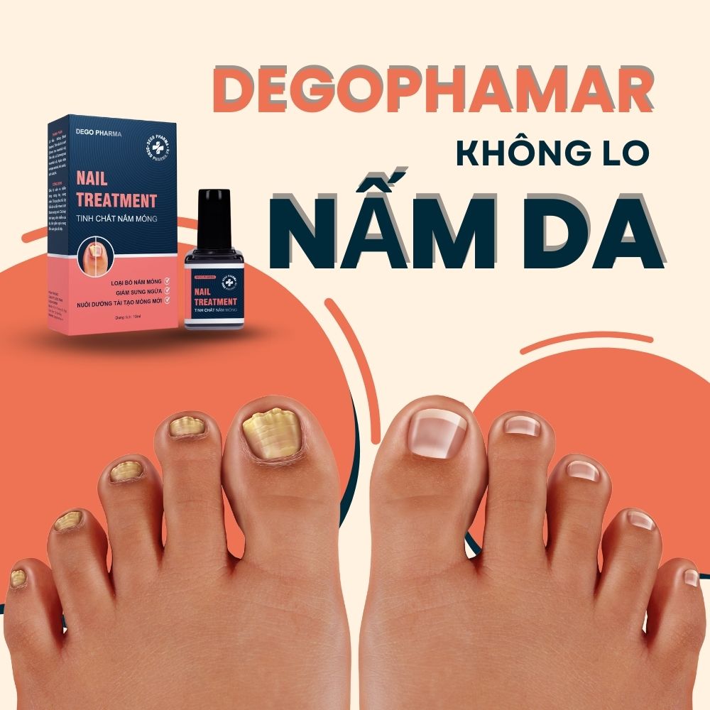 Tinh chất nấm móng Dego Pharma - Giảm nấm móng dứt điểm, giảm sưng ngứa, nuôi dưỡng tái tạo móng mới