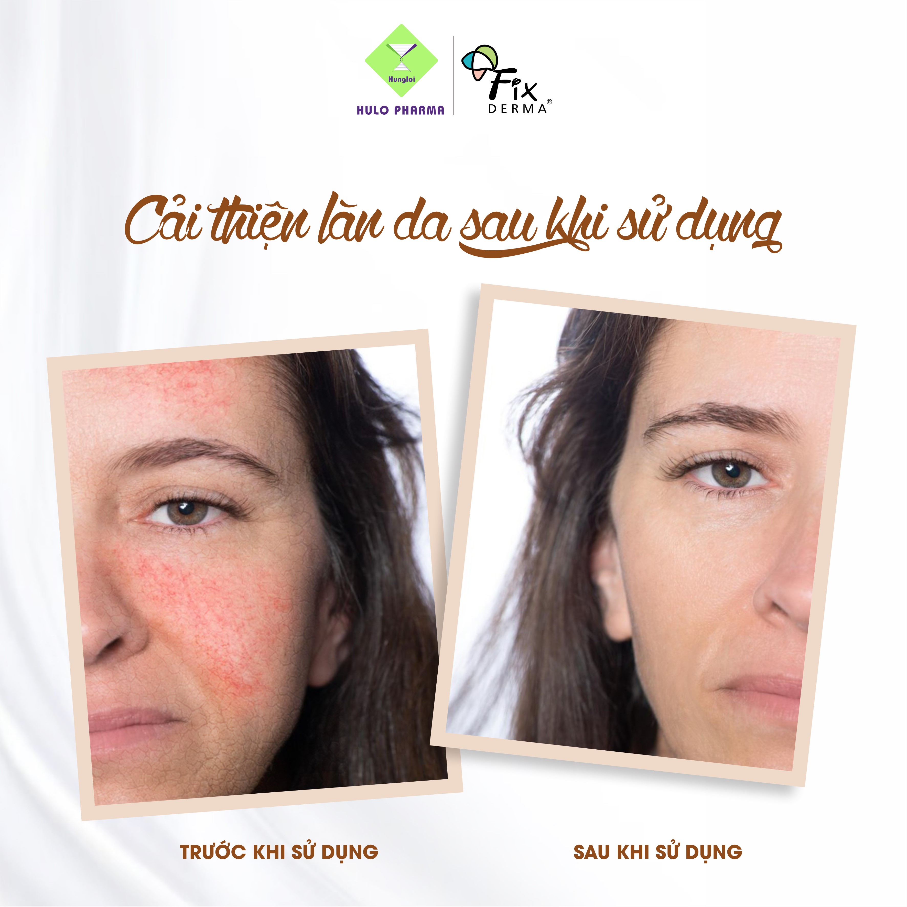 Sữa rửa mặt Fixderma Non Drying Cleanser (60g)