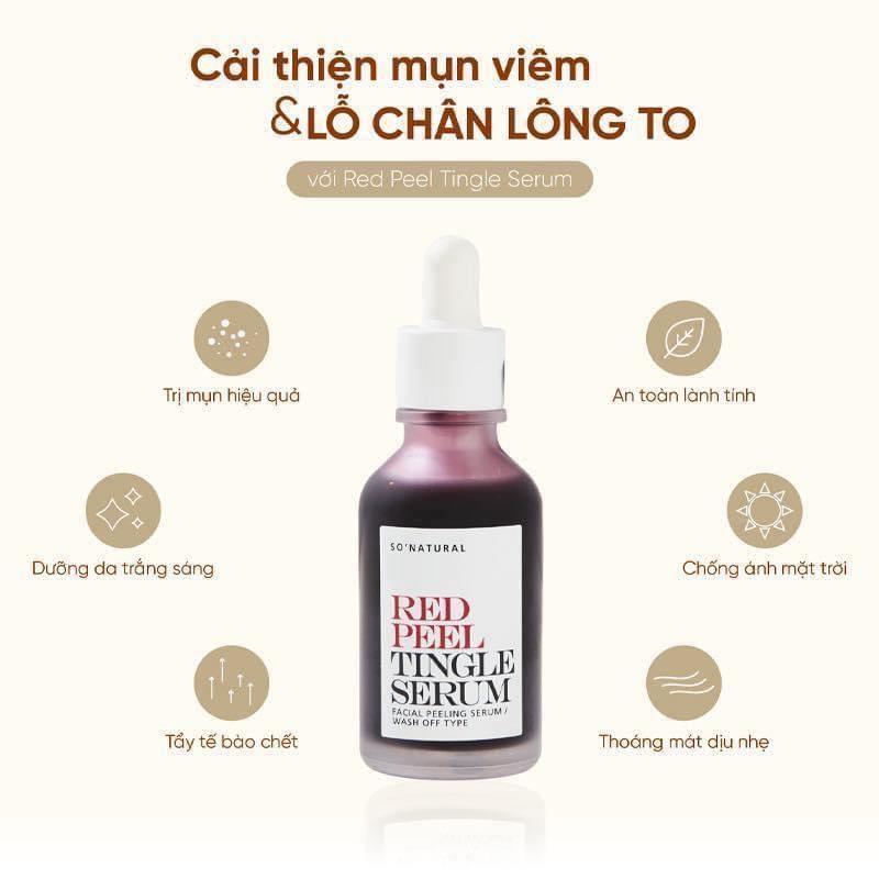 Tinh Chất Thay Da Sinh Học Tẩy Tế Bào Chết da Mặt So’Natural Red Peel Tingle Serum 35ml