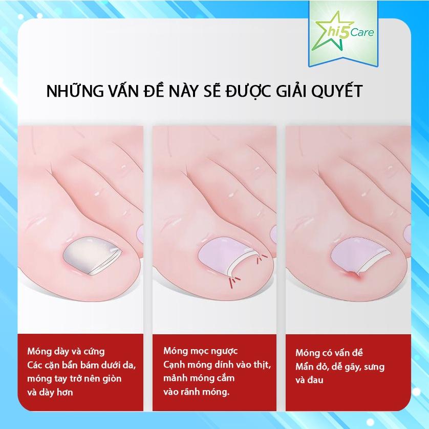 Kìm cắt móng, cắt da chết, kìm cắt móng mọc ngược Chuyên Nghiệp Bằng Thép Không Gỉ #4