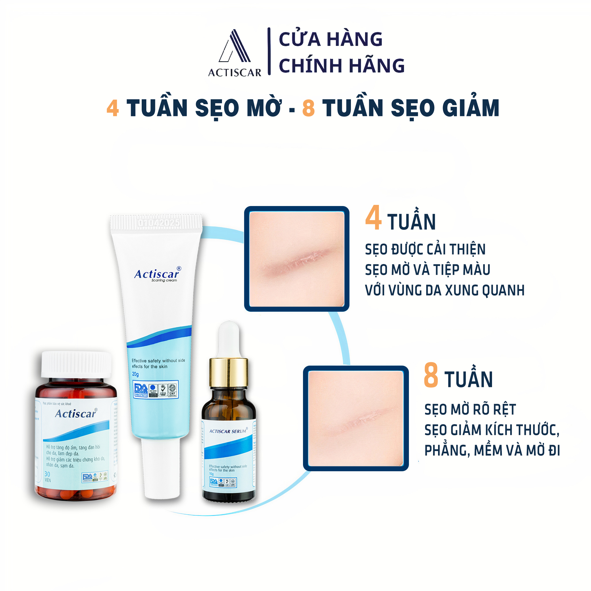 Hỗ Trợ Trị Sẹo Actiscar gồm Kem + Serum + viên uống làm mờ sẹo Lồi, Lõm , Rỗ Thâm