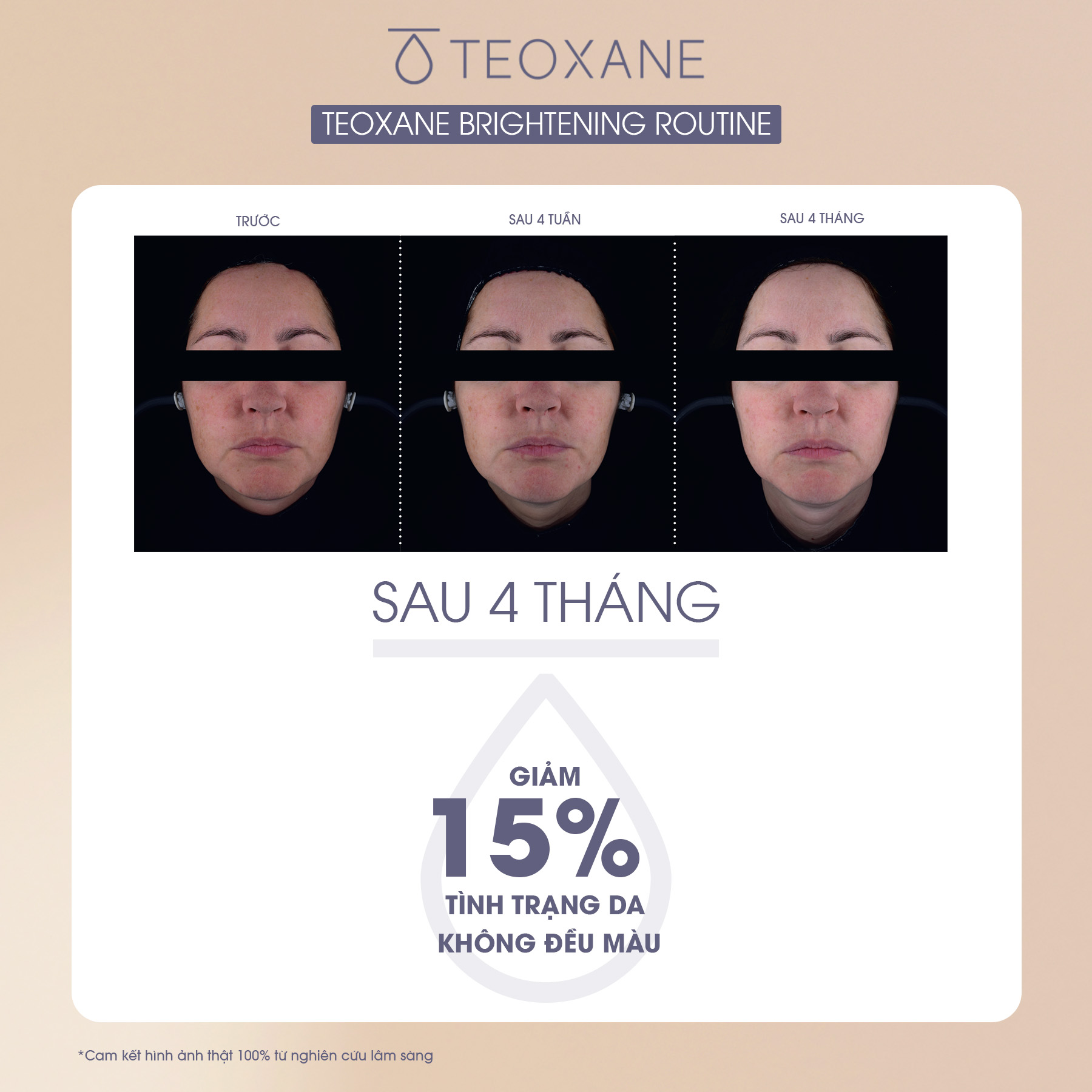 Combo Serum làm sáng, săn chắc da Teoxane RHA Vit C Serum + Kem chống Nắng Teoxane Advanced Perfecting Shield SPF 50+