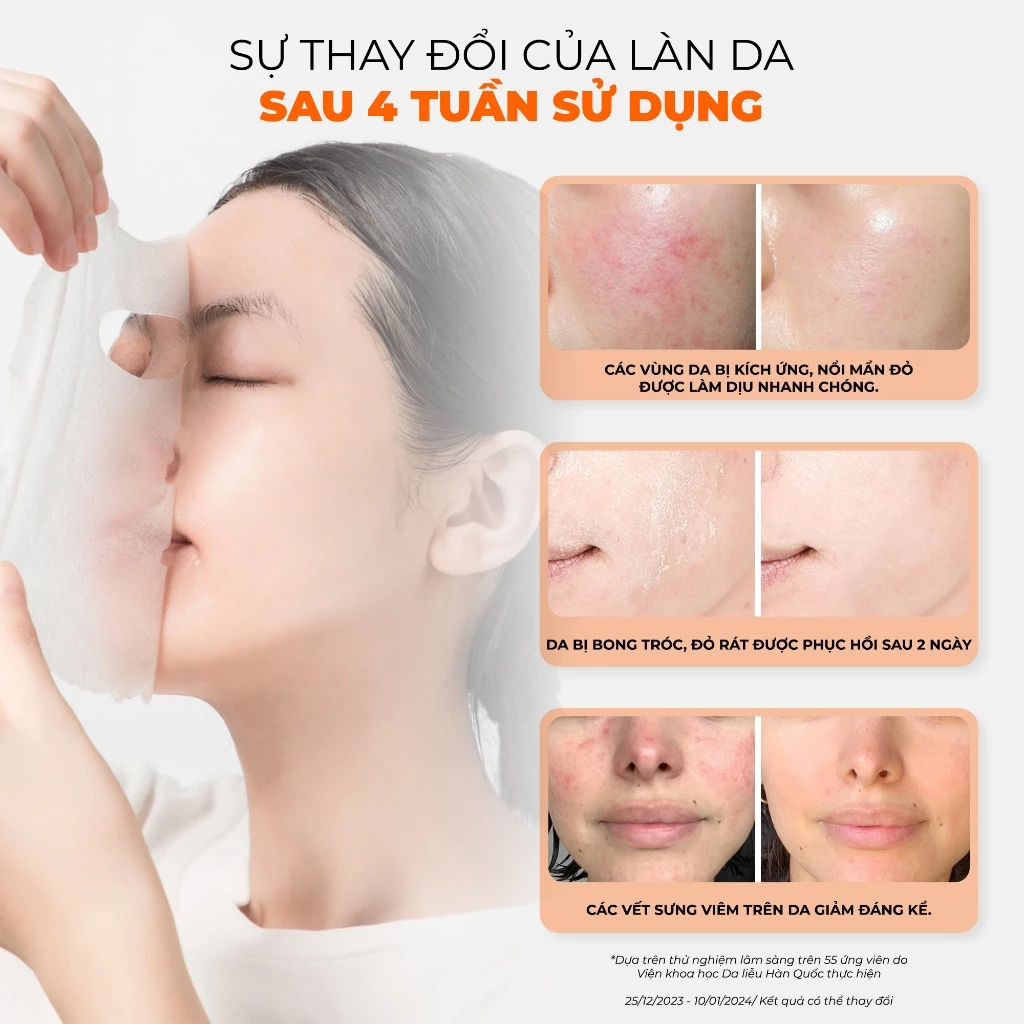 COMBO 10 MẶT NẠ PHỤC HỒI DA BNBG PLACENTA RELAXING SKINBOOSTER 30MLX10