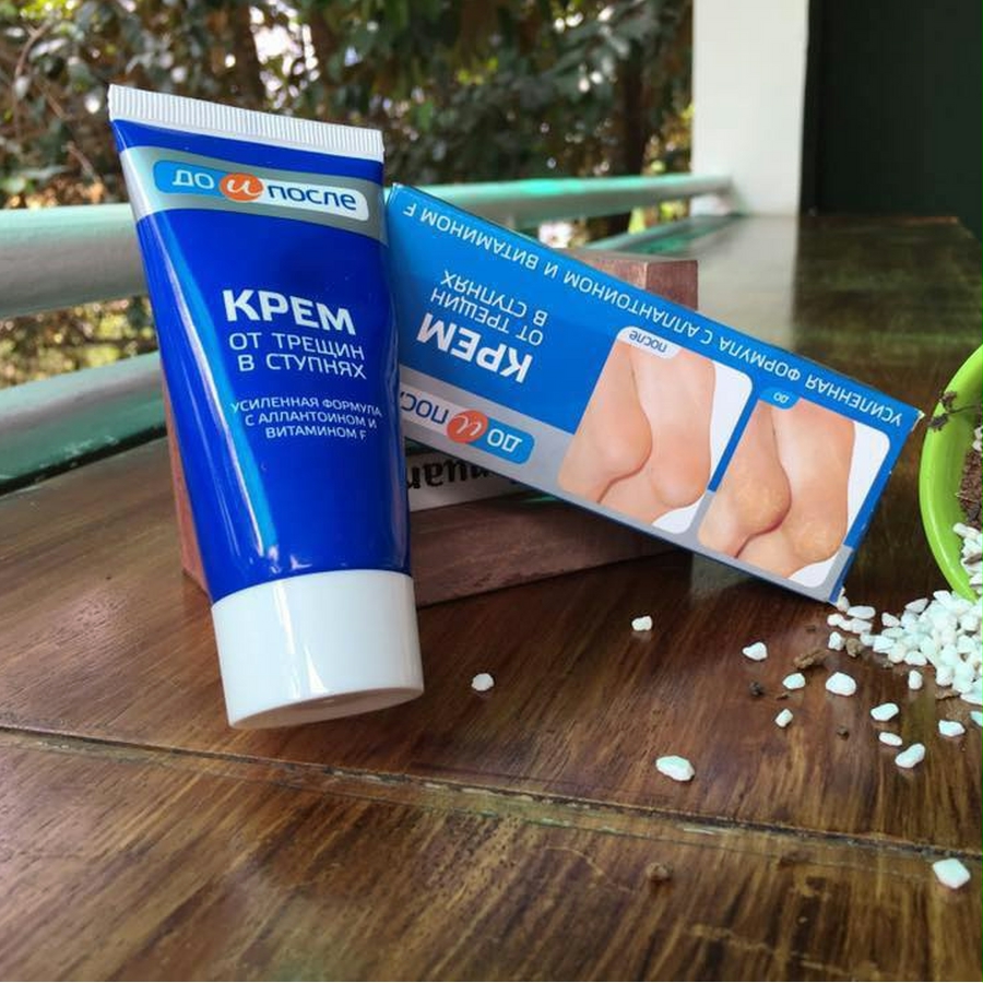 Kem dưỡng ngăn ngừa nứt gót chân Kpem Cream for Carcks in the feet 50ml -  Sản phẩm dưỡng tay, chân | MuaDoTot.com