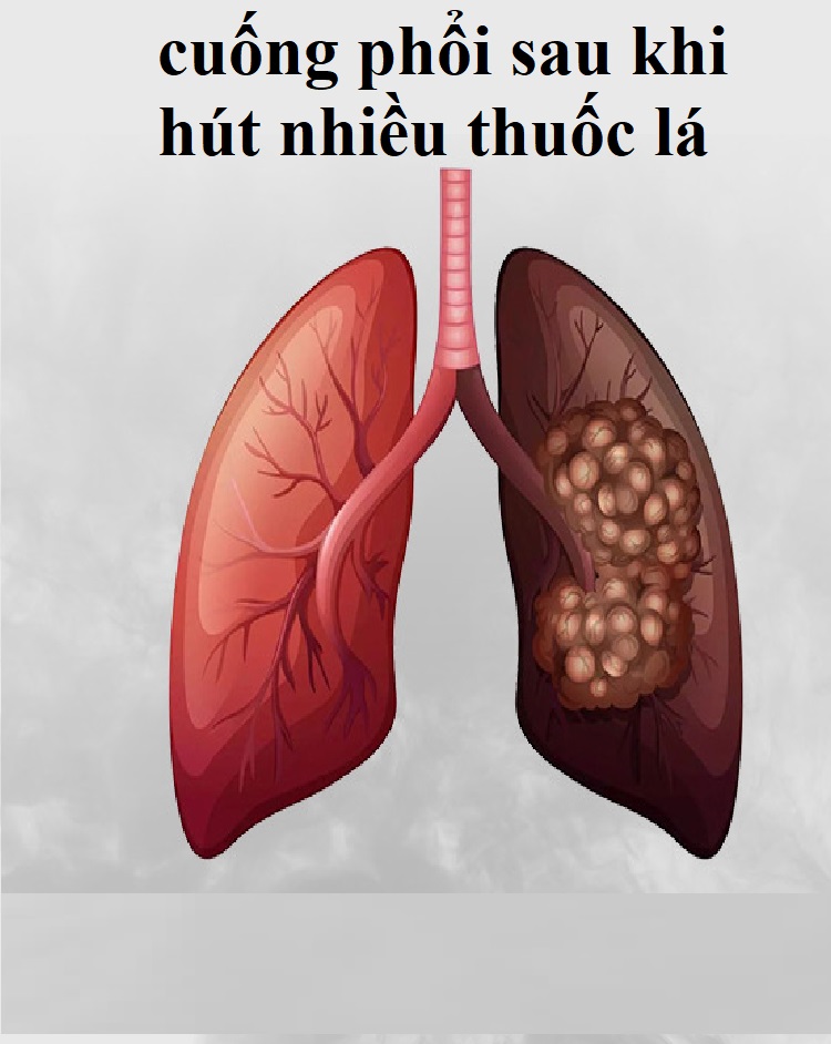 Hộp 100 đầu tẩu thuốc nhựa dẻo bảo vệ sức khỏe Hewang