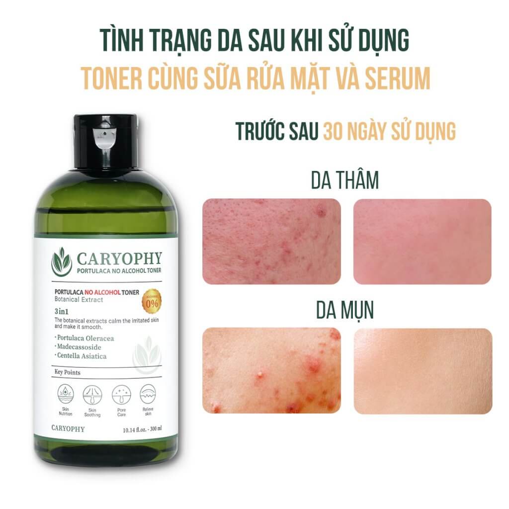 Combo Nước hoa hồng Caryophy Portulaca Toner 300ml + Serum dưỡng ẩm Caryophy Portulaca Ampoule 10ml
