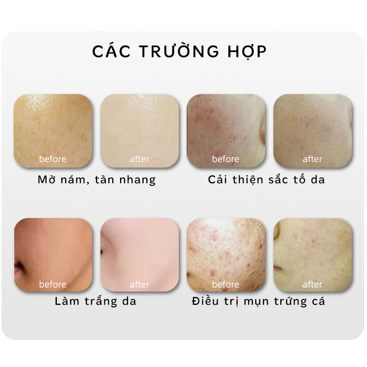 VÒM ÁNH SÁNG SINH HỌC CẢM ỨNG HÀN QUỐC-SIÊU PHẨM THẾ HỆ MỚI