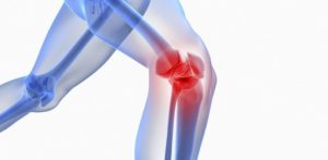 Viên dưỡng khớp Joint Max - Liệu trình 5 hộp 2 Viên dưỡng khớp Joint Max - Liệu trình 5 hộp 2