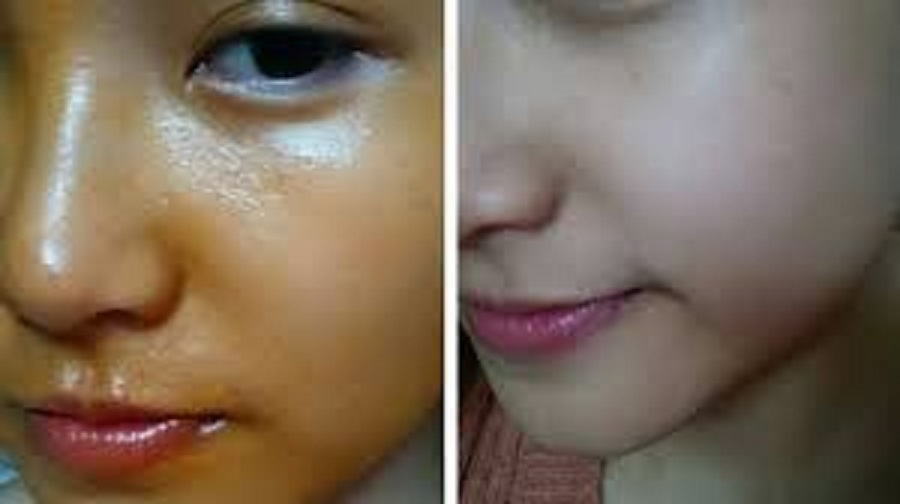 KEM FACE GẤC MẸ KEN