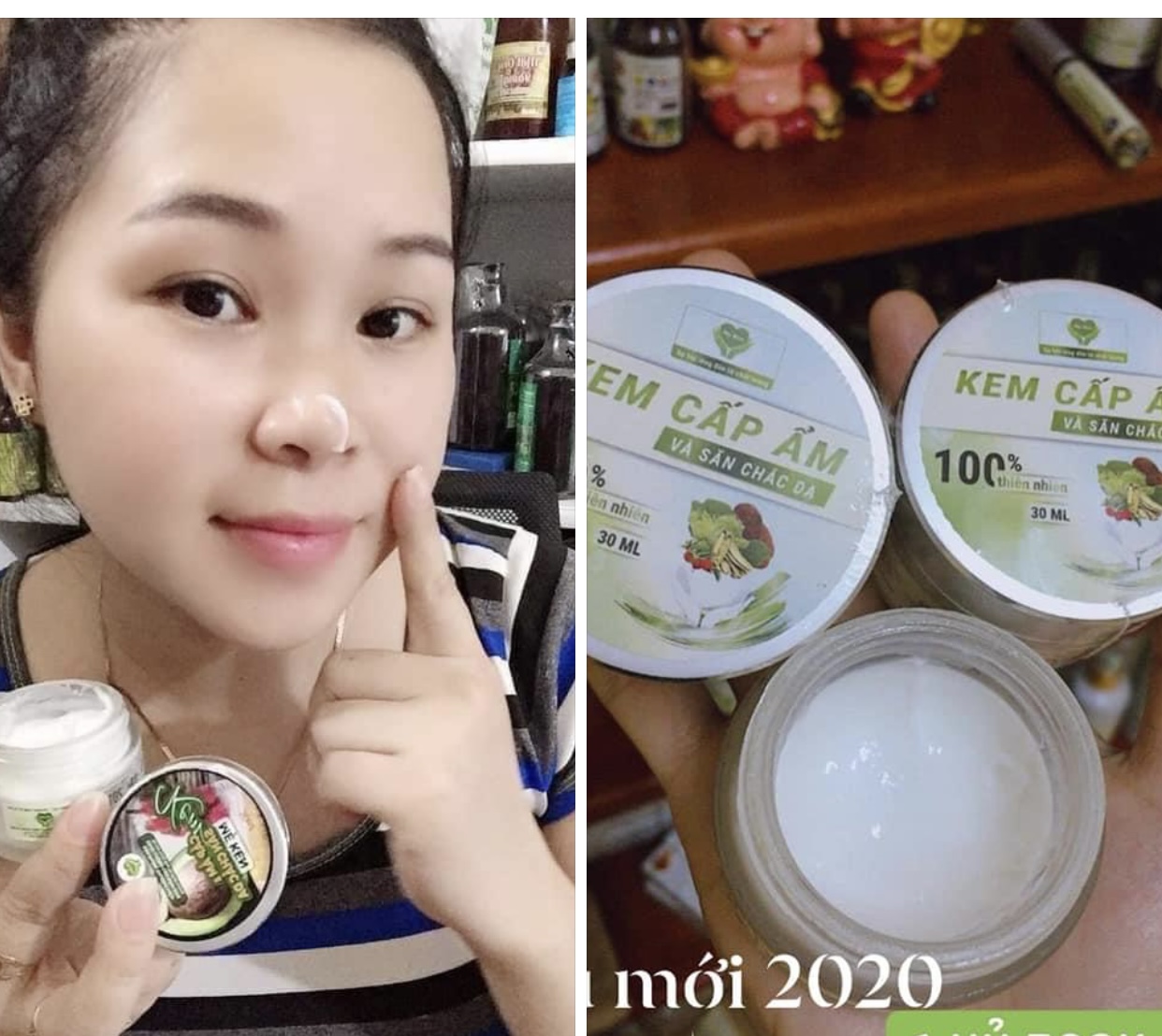 Kem Cấp Ẩm &amp; Săn Chắc Da MẸ KEN 30ml - kem cẩm ẩm cho da