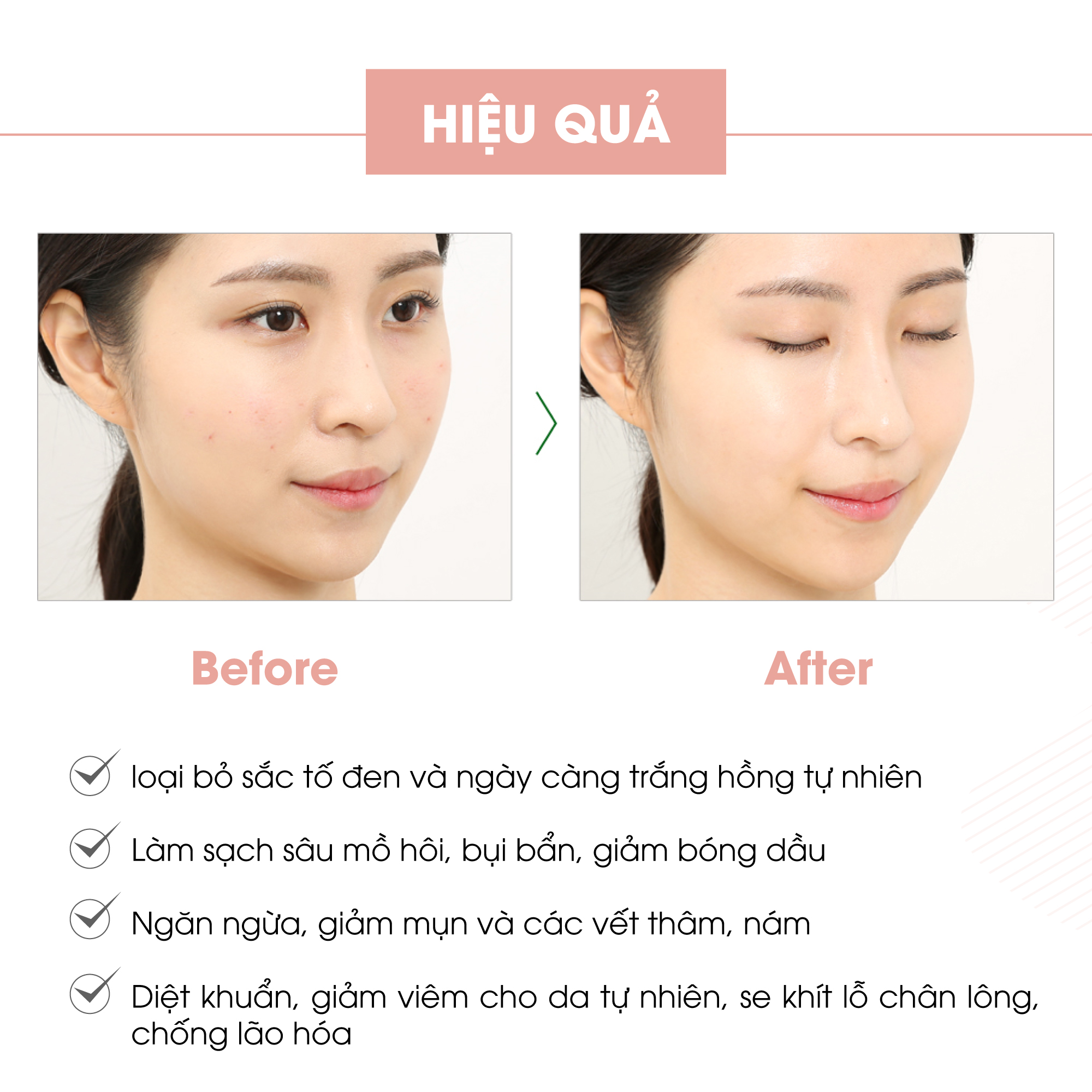 Bộ ngừa mụn da mặt Truesky Premium M02 gồm 1 serum ngừa mụn tràm trà 20ml + 1 sữa rửa mặt than hoạt tính 60ml + 3 miếng mặt nạ tế bào gốc Truesky