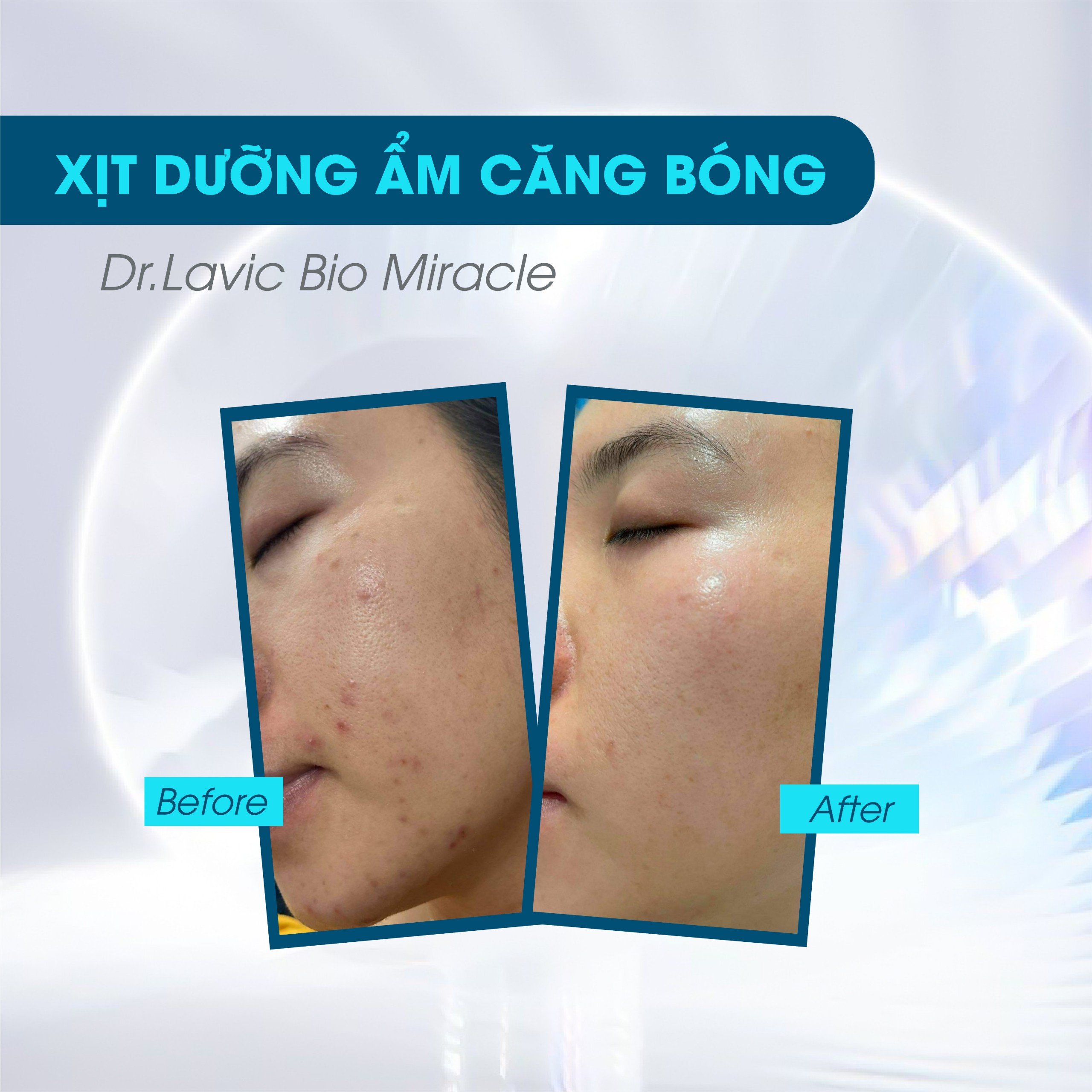 Xịt khoáng mặt dưỡng ẩm Dr.Lavic Bio Miracle dưỡng da cấp nước công nghệ USA 120ml DR933