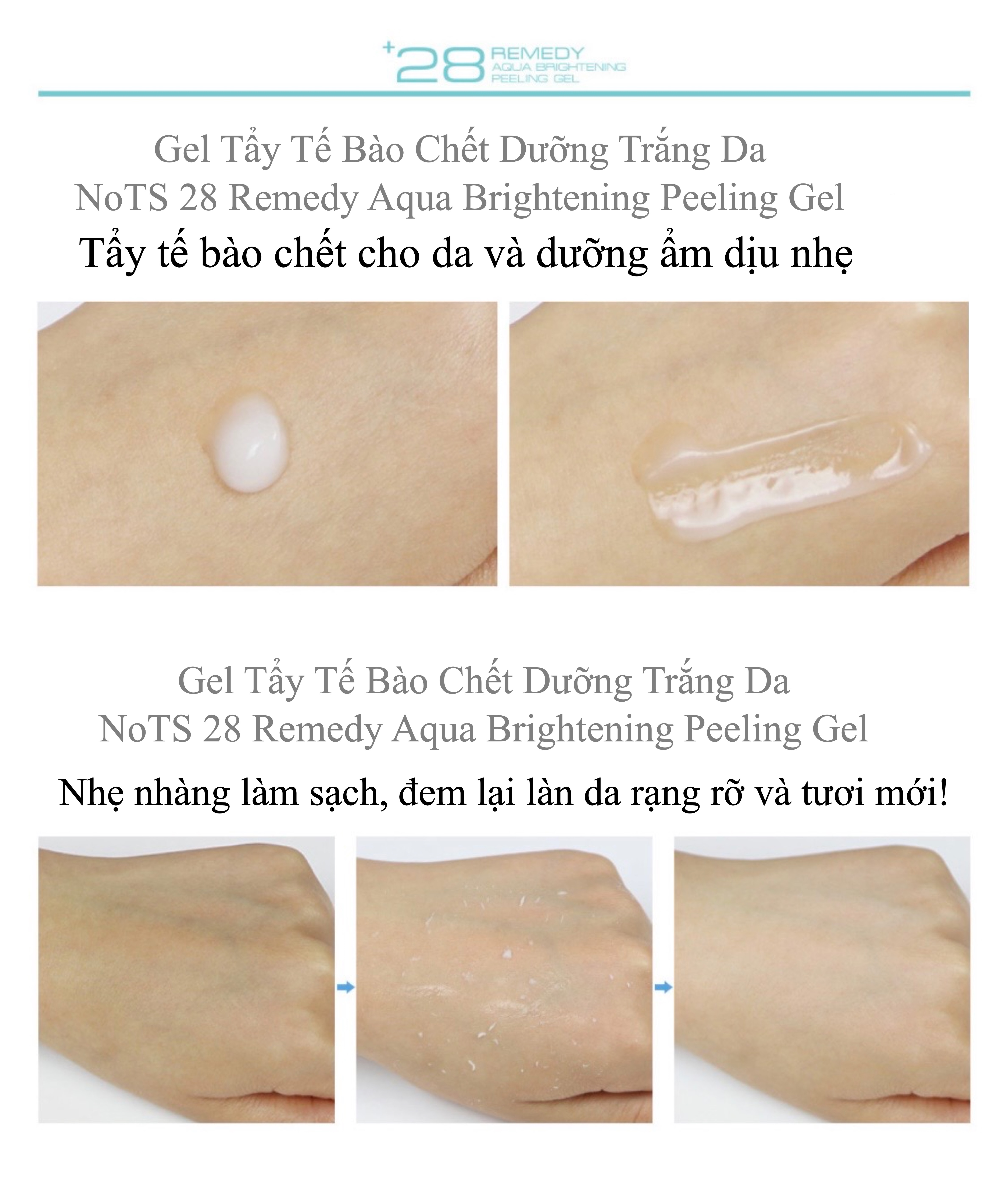 TẨY TẾ BÀO CHẾT NOTS 28 REMEDY QUA BRIGHTENING PEELING GEL