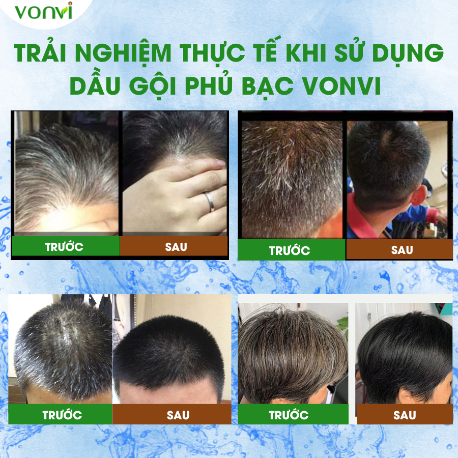 Dầu gội phủ bạc VONVI giúp tóc đen tự nhiên bóng rạng sau 10 phút với thiết kế lược chải đen tóc thông minh, không xót, không làm đen da đầu 200 ml