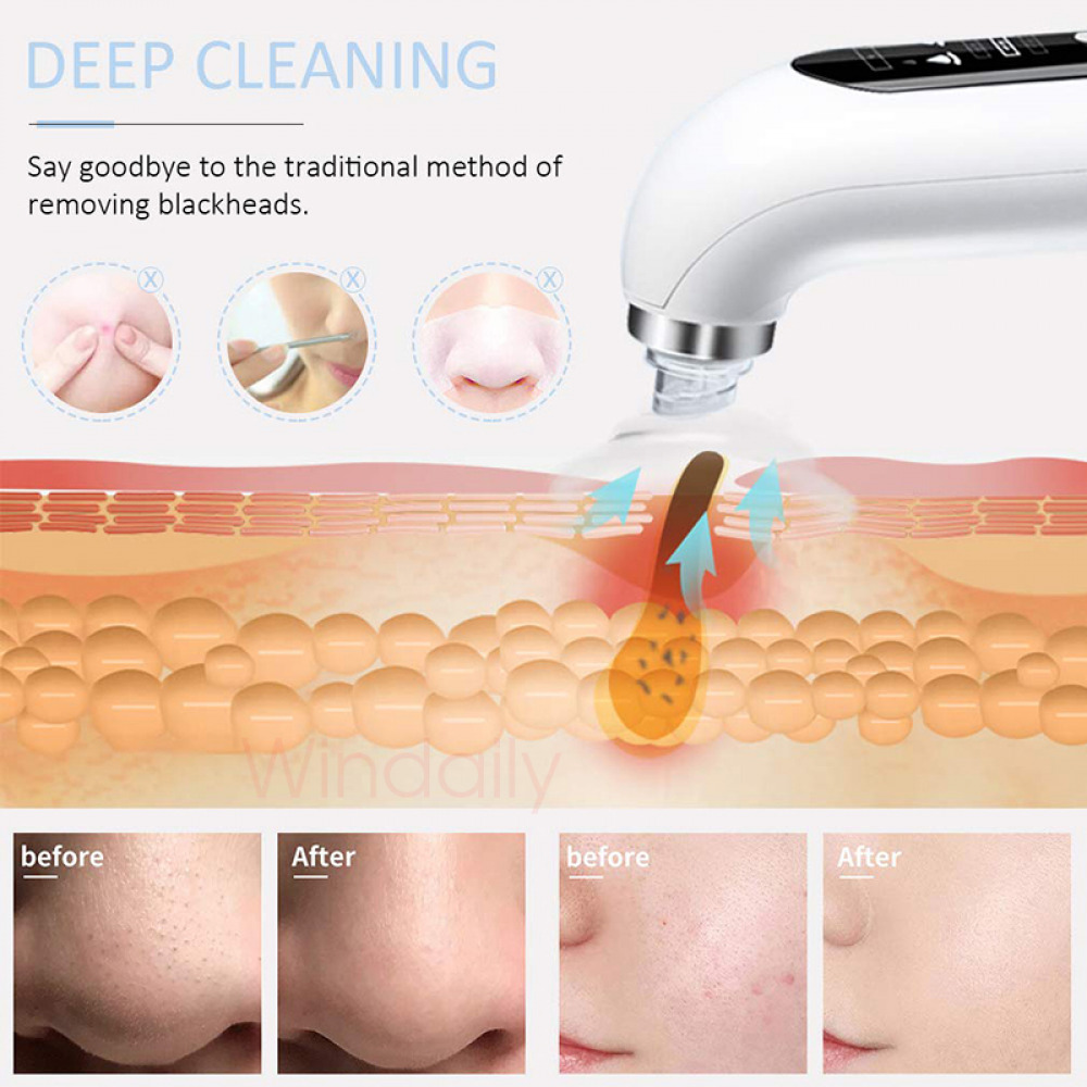 UbodyOasis Đầu đen làm sạch lỗ chân không lỗ chân không Máy clasing mặt bong bóng nhỏ của Micro Micro Thiết bị làm đẹp có thể sạc lại USB