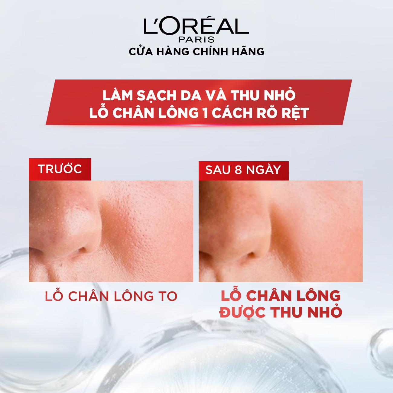 Nước tẩy trang đa năng 3-in-1 L'Oreal Paris Micellar kiềm dầu cho làn da sáng mịn rạng rỡ 400ml