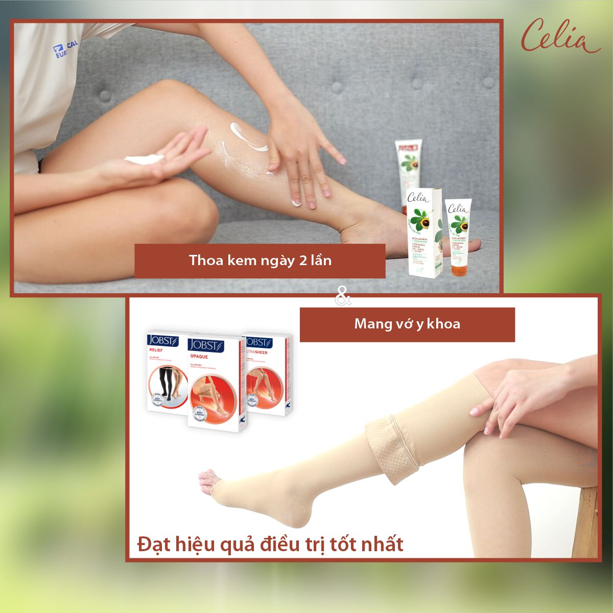 [DATE 12.2027] Kem chăm sóc chân Celia, chiết xuất hạt dẻ ngựa và collagen - Dung tích 100ml