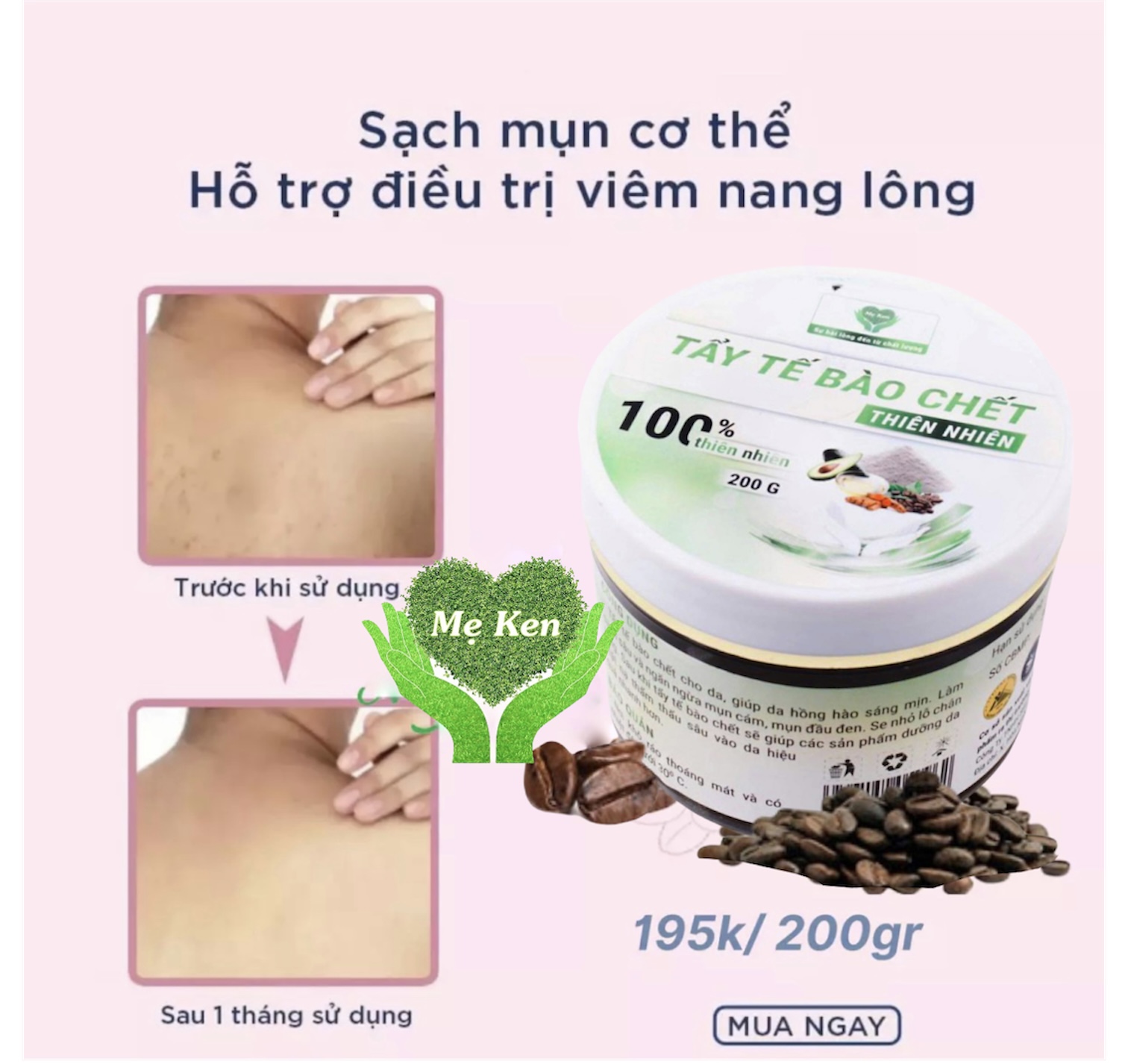 TẨY TẾ BÀO CHẾT LÁNG MỊN BODY MẸ KEN-Hũ 200ml