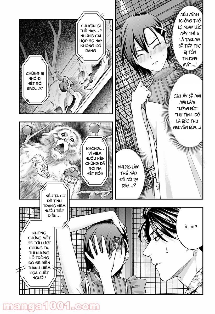 excuse me dentist, its touching me! chapter 30 7