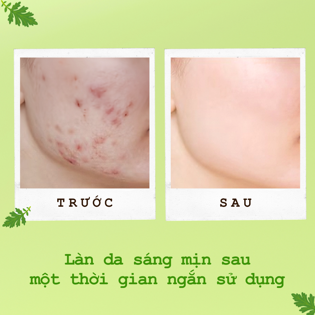 Mặt Nạ Ngủ Ngải Cứu Ngừa Mụn Sáng Da POP