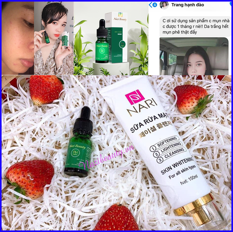 ANTI ACNE SERUM - Serum mụn Nari sản phẩm từ thiên nhiên an toàn lành tính hiệu quả ngay sau 7 ngày lọ 10 ml phù hợp với cả da nhạy cảm