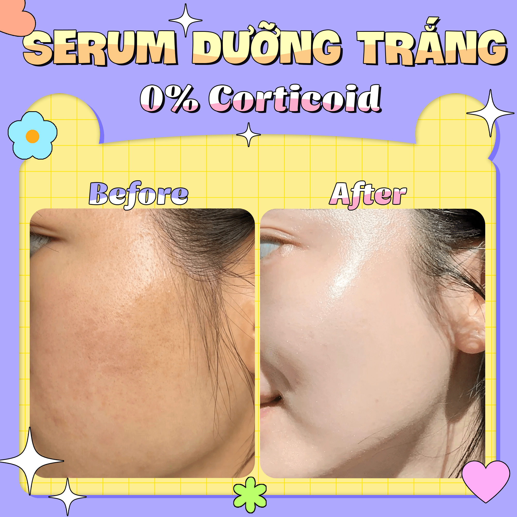 Serum Trắng Sáng Mờ Thâm Ngừa Mụn GUO - White Beauty Serum GUO 30ml