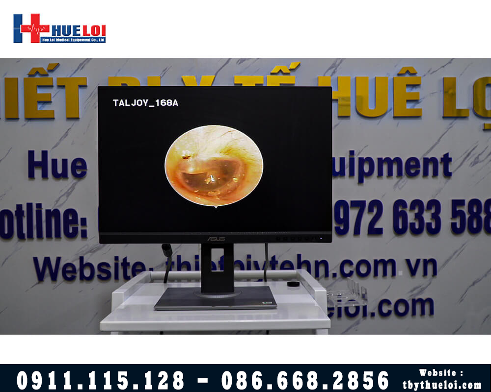 Máy Nội Soi Tai Mũi Họng Full HD -TJ-168A bao gồm cả optic - Hình ảnh sắc nét,độ bền cao