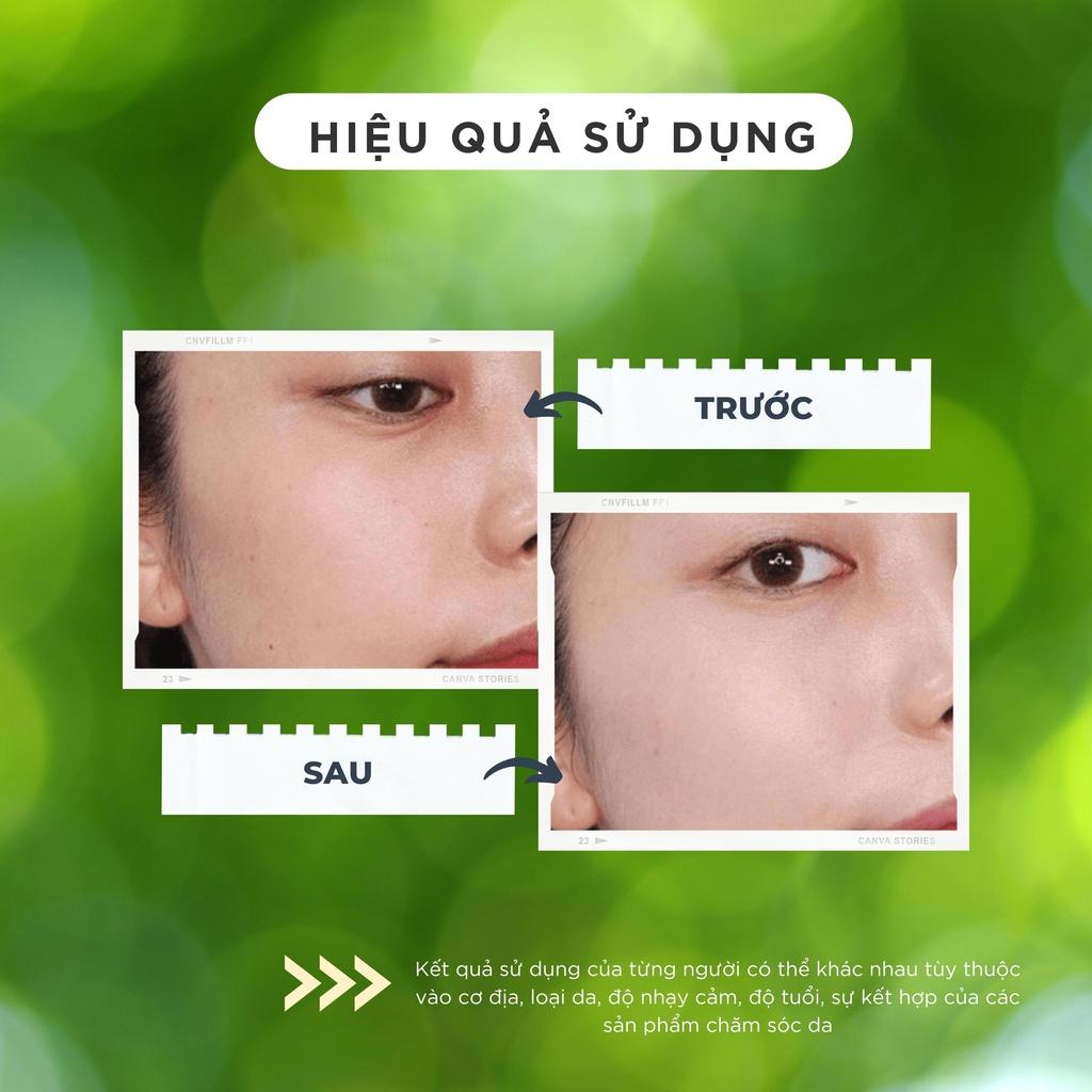 Kem dưỡng trắng ngừa lão hóa da CHAMIS