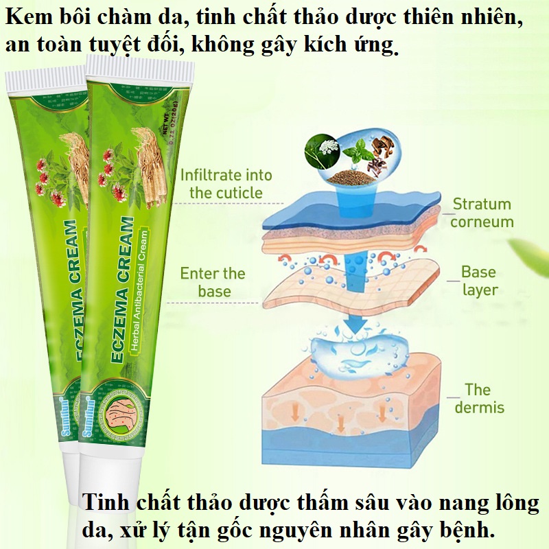 Kem bôi Eczema, chàm khô, chàm nước, ghẻ nước, thành phần thảo dược an toàn tuyệt đối