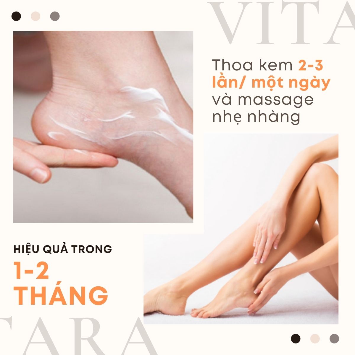 Kem thoa giãn tĩnh mạch Philosoft Legactif cải thiện chứng giãn tĩnh mạch, giảm sưng và dưỡng da 25g