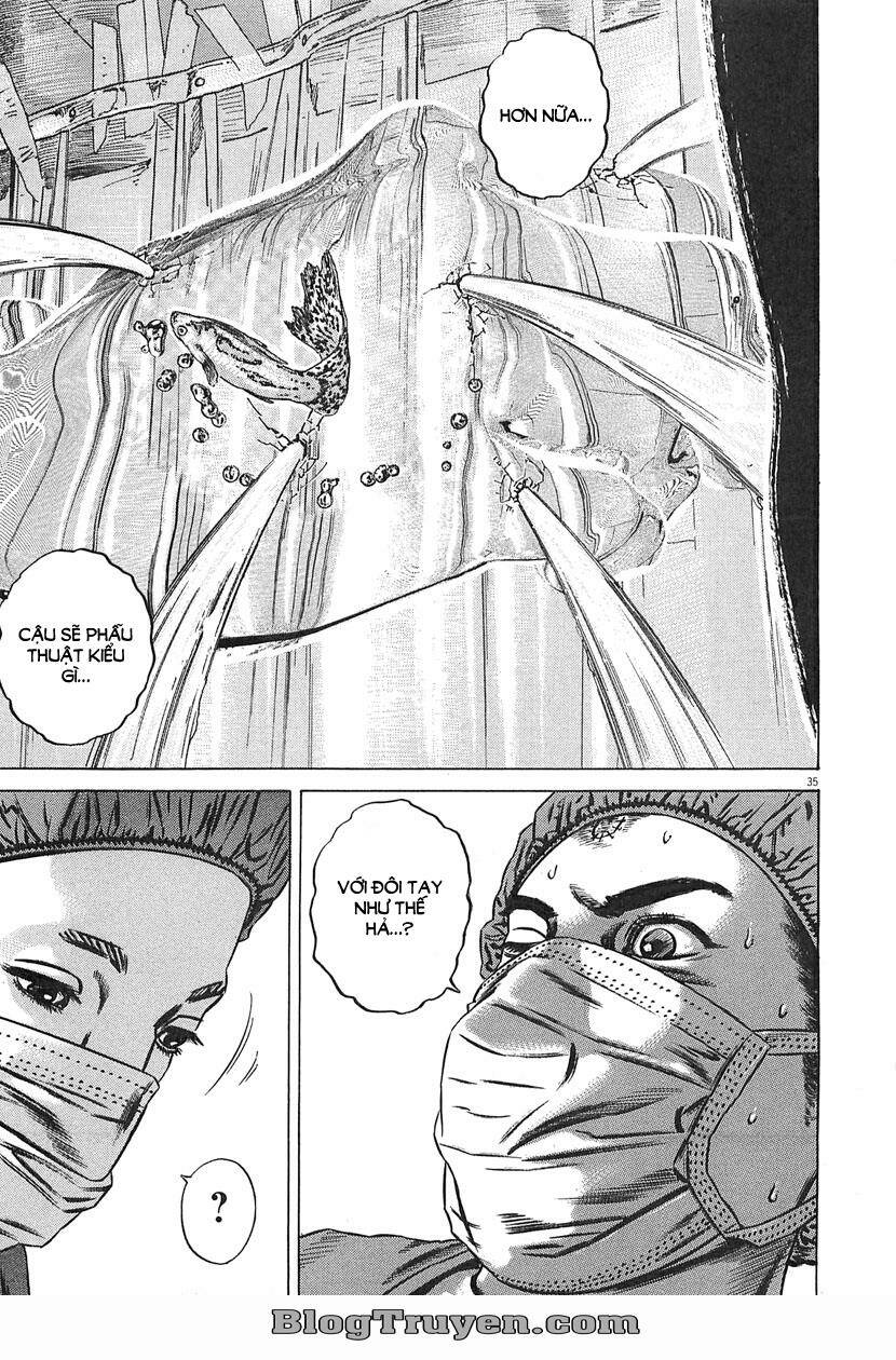 homunculus chapter 63 21