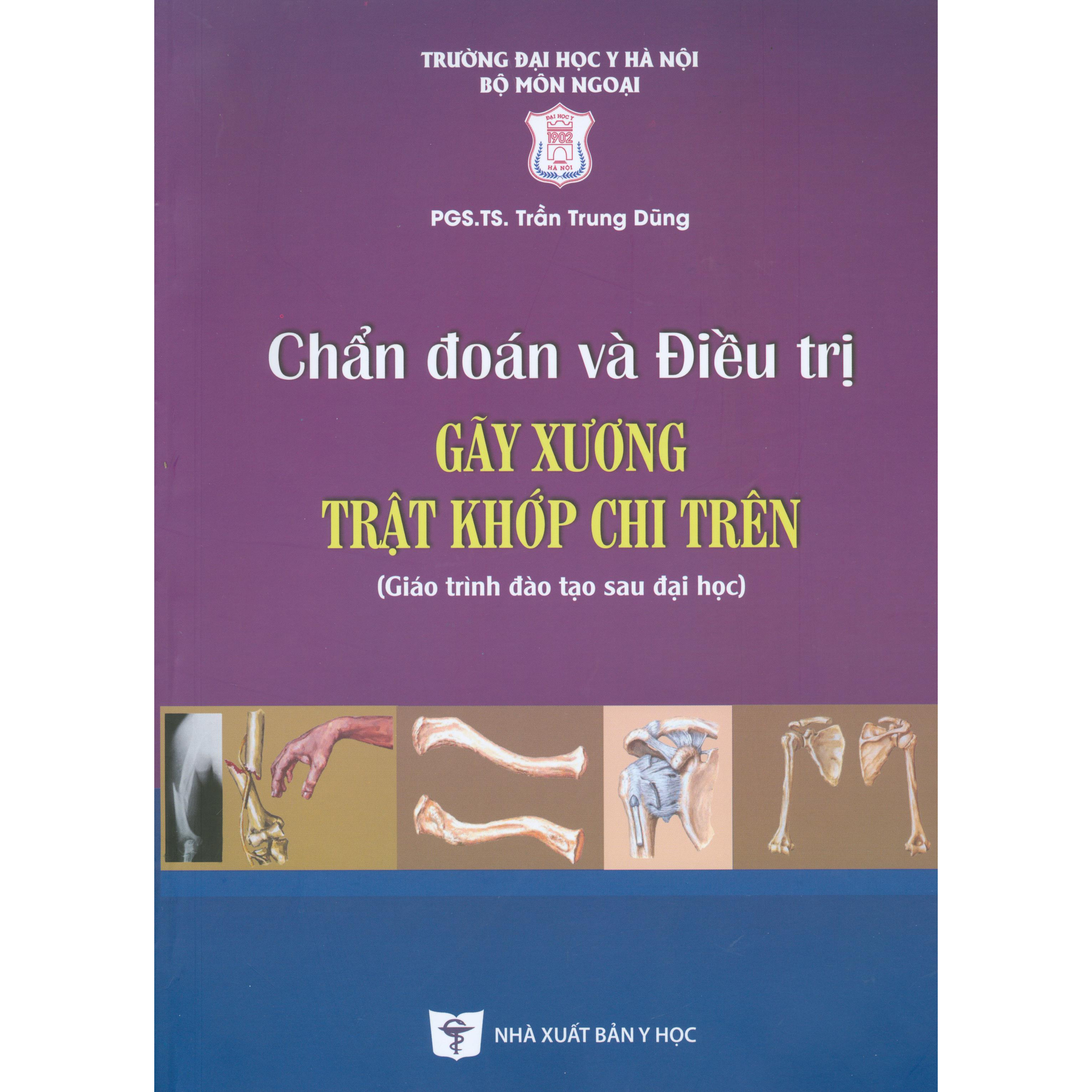 Chẩn Đoán Và Điều Trị Gãy Xương Trật Khớp Chi Trên