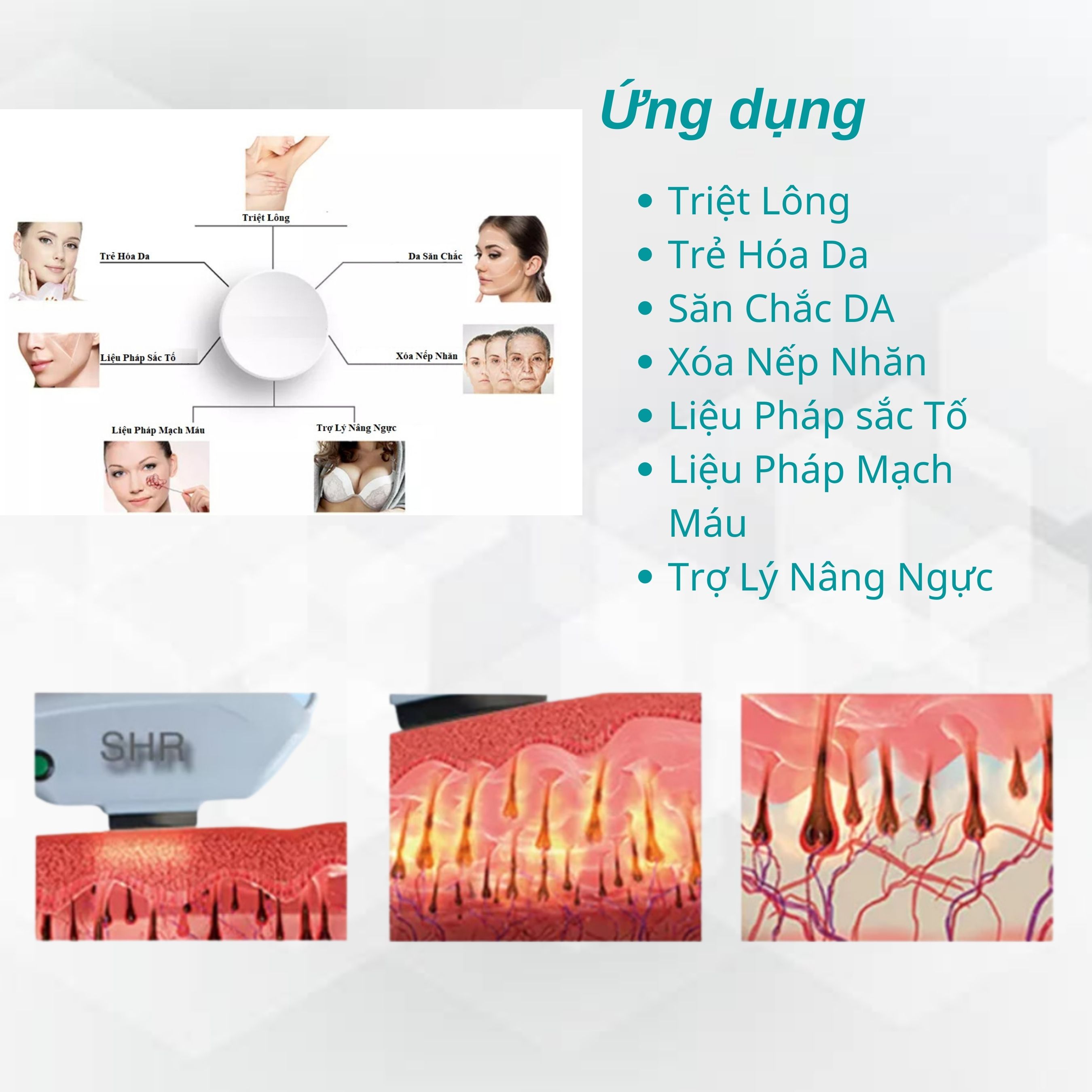 Máy triệt lông công nghệ IPL - SHR VE2000