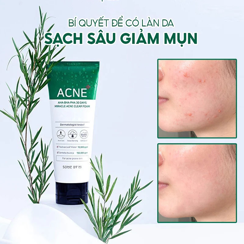 Bộ 4 SP Hỗ Trợ Giảm Mụn Cấp Tốc Some By Mi 30 Days Miracle (Dán mụn 18miếng + SRM 100ml + Kem chấm mụn 30ml + Tinh dầu 10ml)