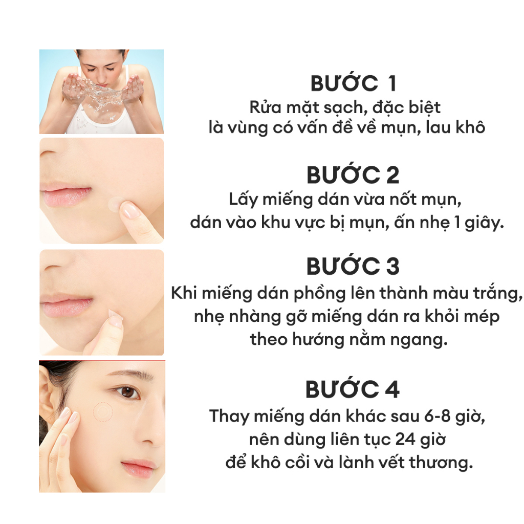 Miếng dán mụn So Natural bản 88 miếng