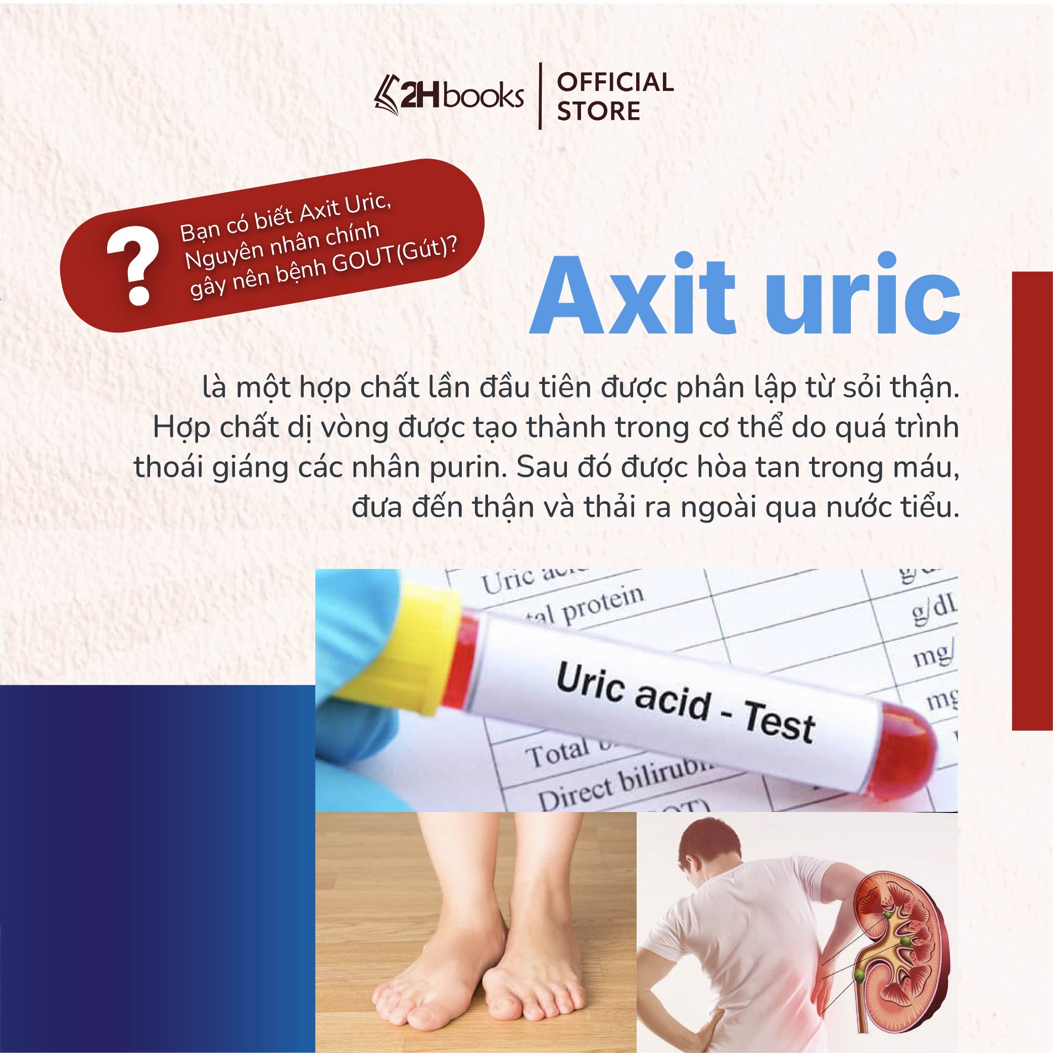 Sách- Chỉ Tại Axit Uric (Xuất Bản 2024)- 2HBooks