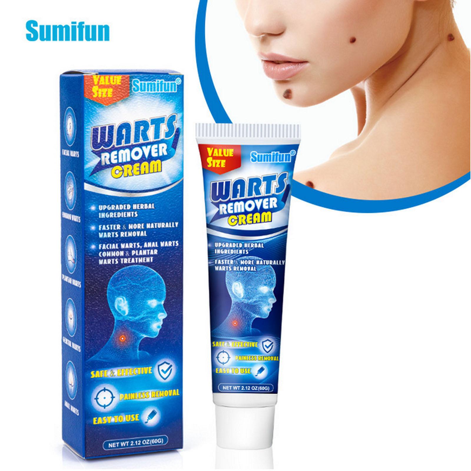 Wart soothing corns cream Ke wart cream