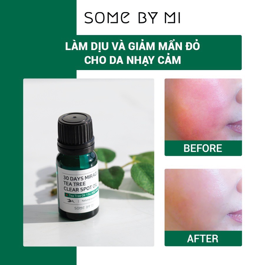 Tinh Dầu Tràm Trà Some By Mi 30 Days Miracle Tea Tree Clear Spot Oil 10ml