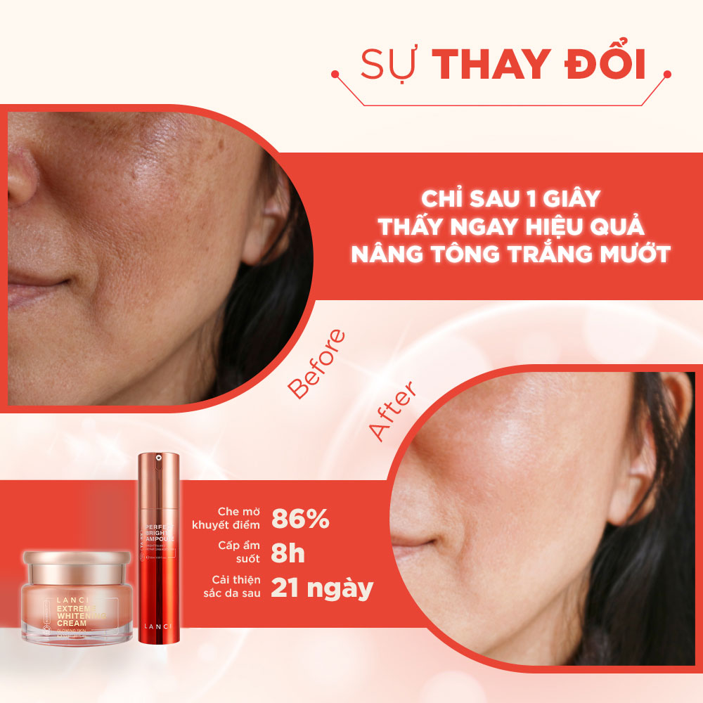 Combo Dưỡng Trắng 3D-BRIGHTY LANCI 50ml