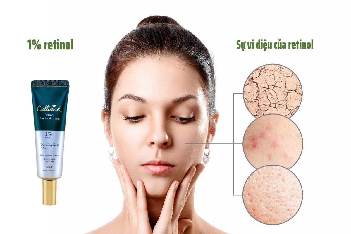 Kem Dưỡng Tái Tạo Chống Lão Hoá Da Retinol 1.0 Calliané Hàn Quốc